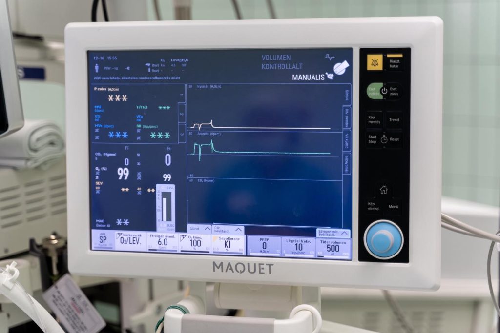 Beteg monitor